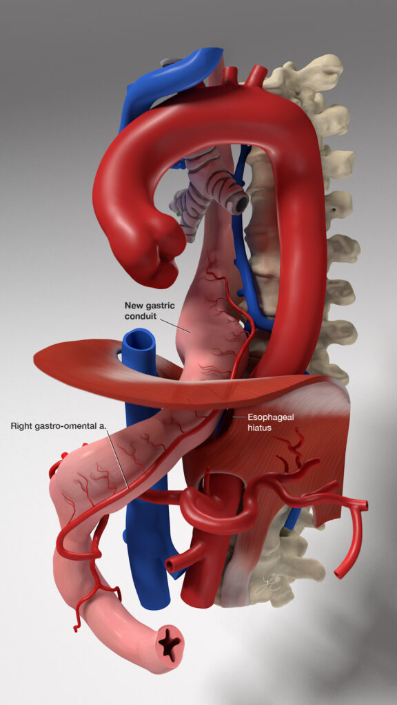 esophagus model